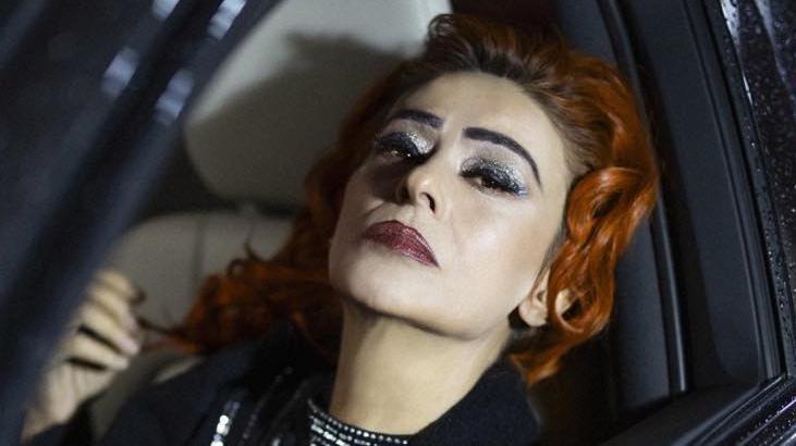 Yüzünde kimyasal yanık oluşmuştu! Yıldız Tilbe son halini paylaştı